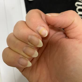 Flormar Oje Tırnakta Sarı Leke Bıraktı, Çıkmıyor