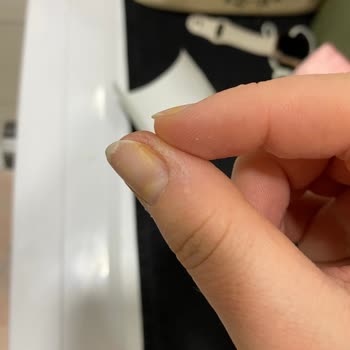 Flormar Oje Tırnakta Sarı Leke Bıraktı, Çıkmıyor