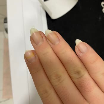 Flormar Oje Tırnakta Sarı Leke Bıraktı, Çıkmıyor