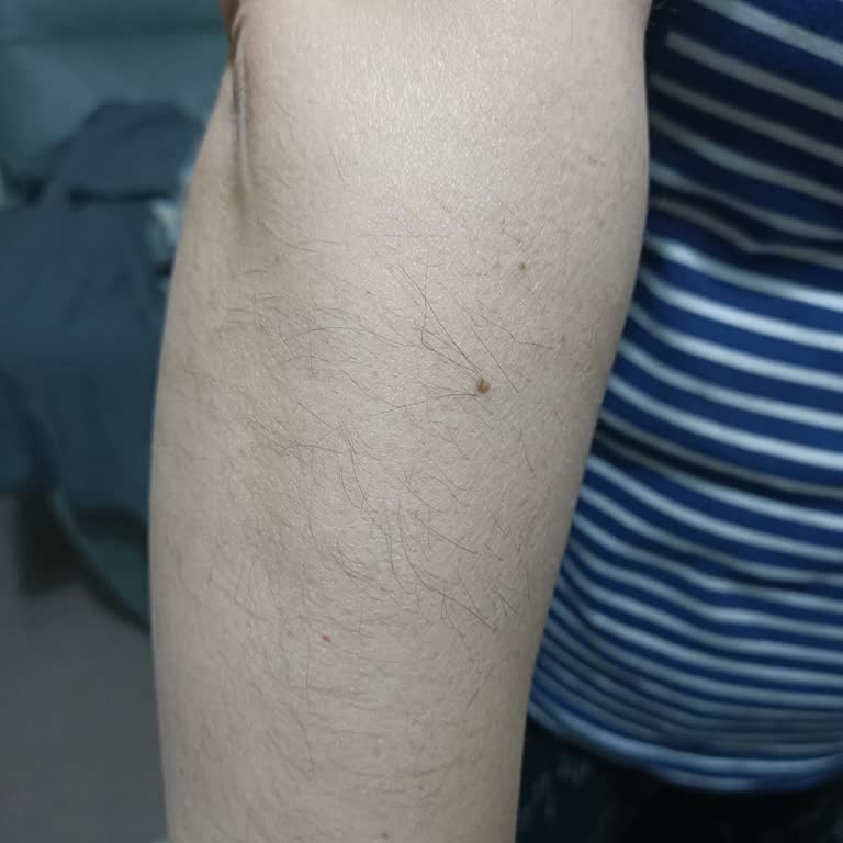 Epilasyon Sonrası Sonuç Yok, Yorumlara Erişim Engelli