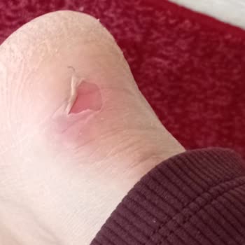 Aldığımız Bot Ayağımızı Yaraladı, FLO Mağduriyetimizi Gidermiyor