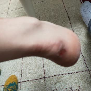 Aldığımız Bot Ayağımızı Yaraladı, FLO Mağduriyetimizi Gidermiyor