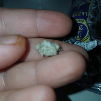 Çerezya Çekirdek Paketinden Çıkan Diken Ağzımı Yaraladı