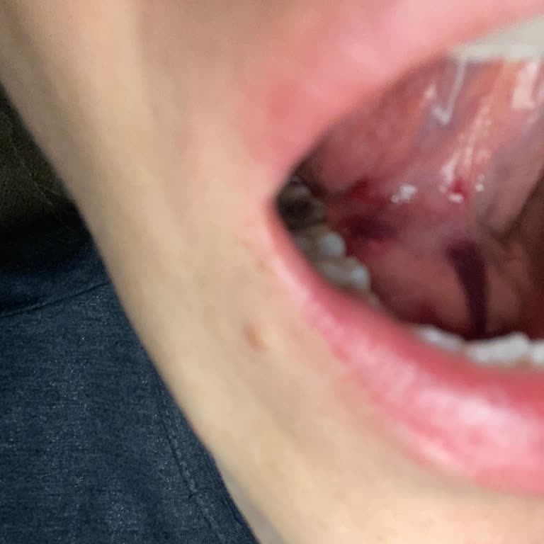 Diş Tedavisinde Yaşadığım Ağrı Ve İlgisizlik Mağduriyeti