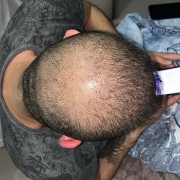 Kalıcı Boya Vaadi Yerine Getirilmedi, Ücret İadesi Talebim Var