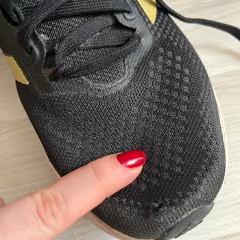 Adidas Aldığım Ayakkabıda Kısa Sürede Deformasyon Ve İlgisiz Mağaza Yaklaşımı