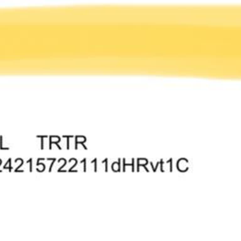 QNB KOBİ Kartıma Haksız Yıllık Üyelik Ücreti Yansıtıldı