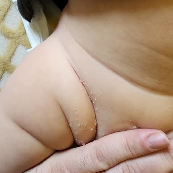 Molfix Bebek Bezinde Granül Sorunu Yaşanıyor