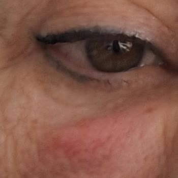 Yanlış Uygulama Sonrası Sağlık Sorunları Ve İlgisiz Davranış