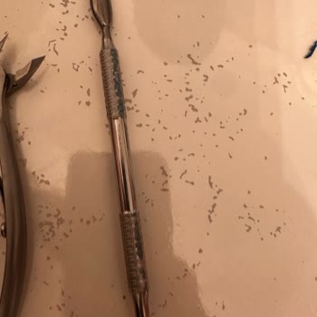 Yanlış Bilgi Nedeniyle Sterilizasyon Fırınında Tüm Ürünlerim Yandı