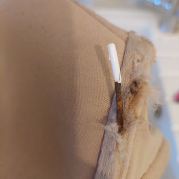 Penti Sutyende Paslı Tel Şoku Ve Kaşıntı Sorunu