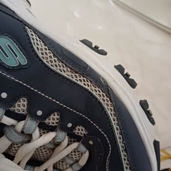 Skechers Ayakkabılarda Sürekli Kalite Sorunu Yaşadım