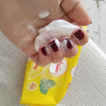 Dalin Islak Mendil Ve El Sabunu Ciltte Tahrişe Sebep Oldu