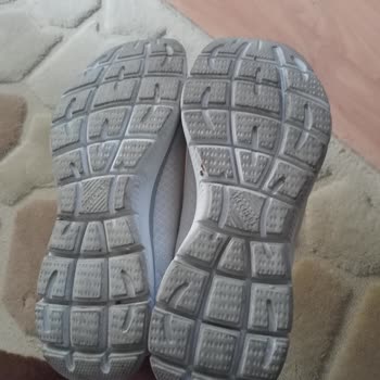 Kaygan Skechers Ayakkabı Nedeniyle Hastanelik Oldum, Sakatlanıyordum