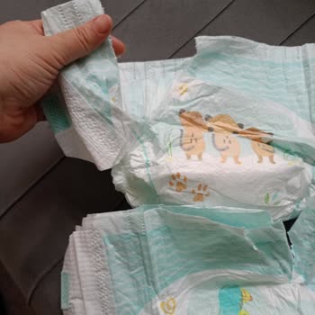 Prima Bebek Bezlerinde Kanat Kısımlarının Sürekli Yırtılması