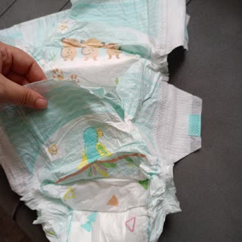 Prima Bebek Bezlerinde Kanat Kısımlarının Sürekli Yırtılması