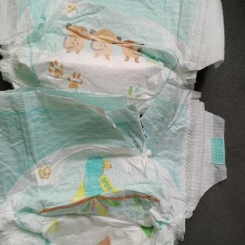 Prima Bebek Bezlerinde Kanat Kısımlarının Sürekli Yırtılması