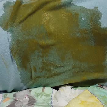 Bebek Bezinde Sızdırma Ve Emicilik Sorunu Yaşadım