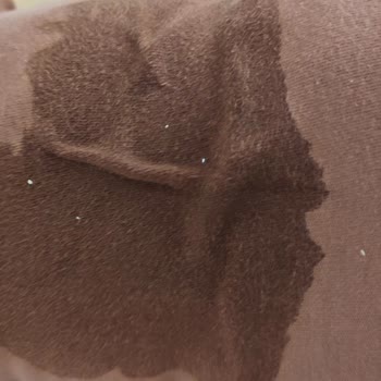 Bebek Bezinde Sızdırma Ve Emicilik Sorunu Yaşadım