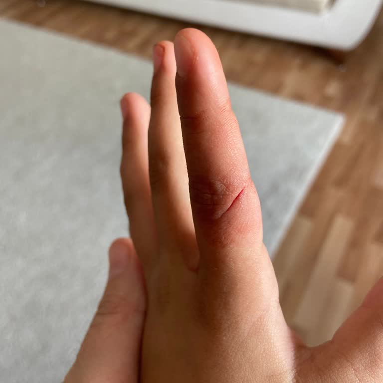 Acilde Küçük Müdahale İçin Yüksek Ücret Talebi Mağduriyet Yarattı