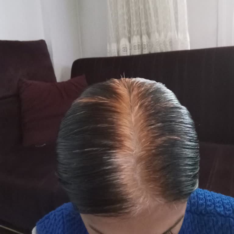 Aldığım Saç Açıcı Beklediğim Sonucu Vermedi