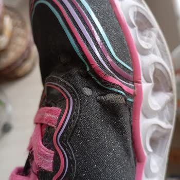 Boyner'den Alınan Skechers Ayakkabının 6 Ayda Yırtılması ve İade Reddi Mağduriyeti