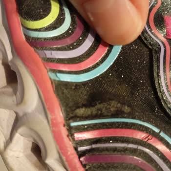 Boyner'den Alınan Skechers Ayakkabının 6 Ayda Yırtılması ve İade Reddi Mağduriyeti