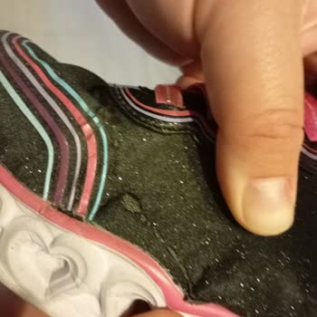 Boyner'den Alınan Skechers Ayakkabının 6 Ayda Yırtılması ve İade Reddi Mağduriyeti