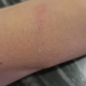 İstanbul Pastanesi Otomatik Kapı Kazası ve İlgisiz Personel