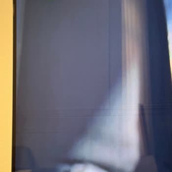 LG TV Ekranında Tekrar Eden Piksel Sorunu Ve Servis İletişimsizliği