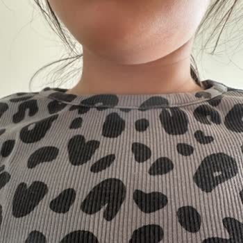 Şentepe Ağız ve Diş Sağlığı Polikliniği'nden Şikayetçiyim