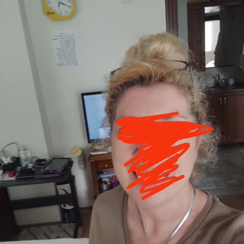 Yanlış Paketlenen Saç Boyası Nedeniyle Mağduriyet Ve İlgisiz Müşteri Hizmeti