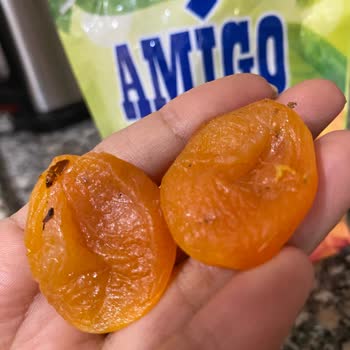 Kuru Kayısıdan Çıkan Sert Madde Dişimi Kırdı, Mağduriyet Yaşadım