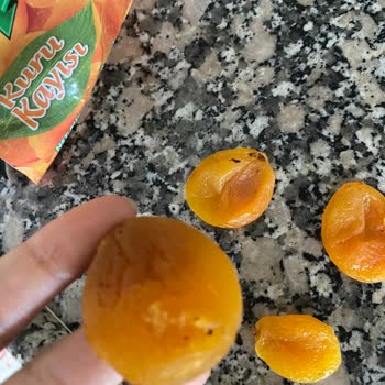 Kuru Kayısıdan Çıkan Sert Madde Dişimi Kırdı, Mağduriyet Yaşadım