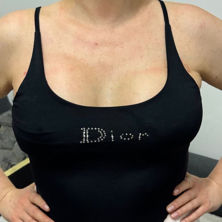Op. Dr. Teoman Eraslan Hayal Kırıklığına Uğratan Ve Pahalıya Mal Olan Bir Deneyim
