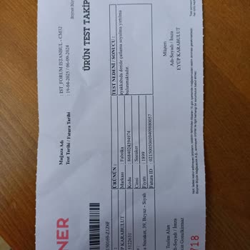 Kısa Sürede Hasar Gören Ayakkabı Ve İlgisiz Mağaza Yaklaşımı