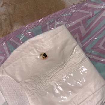 Molped Gece Pedi İçinde Böcek Şoku: Hijyen Sıfır!