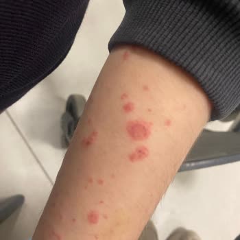 Çocuğumun Tedavisinde İhmal Ve İlgisizlik Nedeniyle Yaşadığımız Mağduriyet