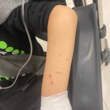 Çocuğumun Tedavisinde İhmal Ve İlgisizlik Nedeniyle Yaşadığımız Mağduriyet