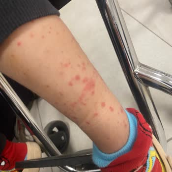 Çocuğumun Tedavisinde İhmal Ve İlgisizlik Nedeniyle Yaşadığımız Mağduriyet