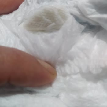 Bebek Bezinde Sakız Benzeri Yabancı Madde Ve Hijyen Sorunu