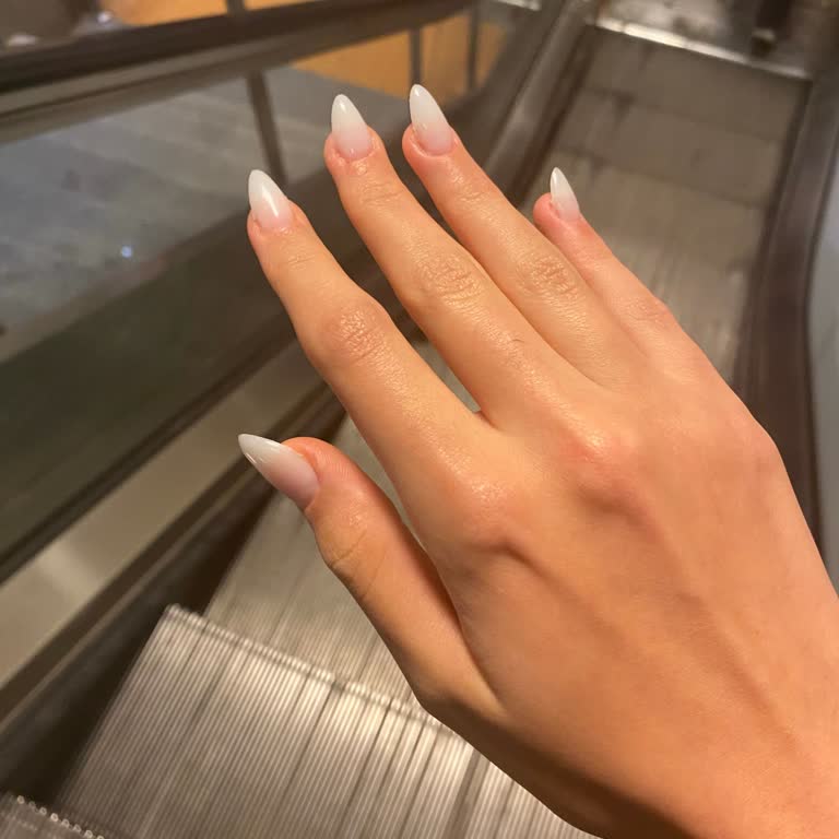 Hijyen Eksikliği Ve Kötü Hizmet Deneyimi