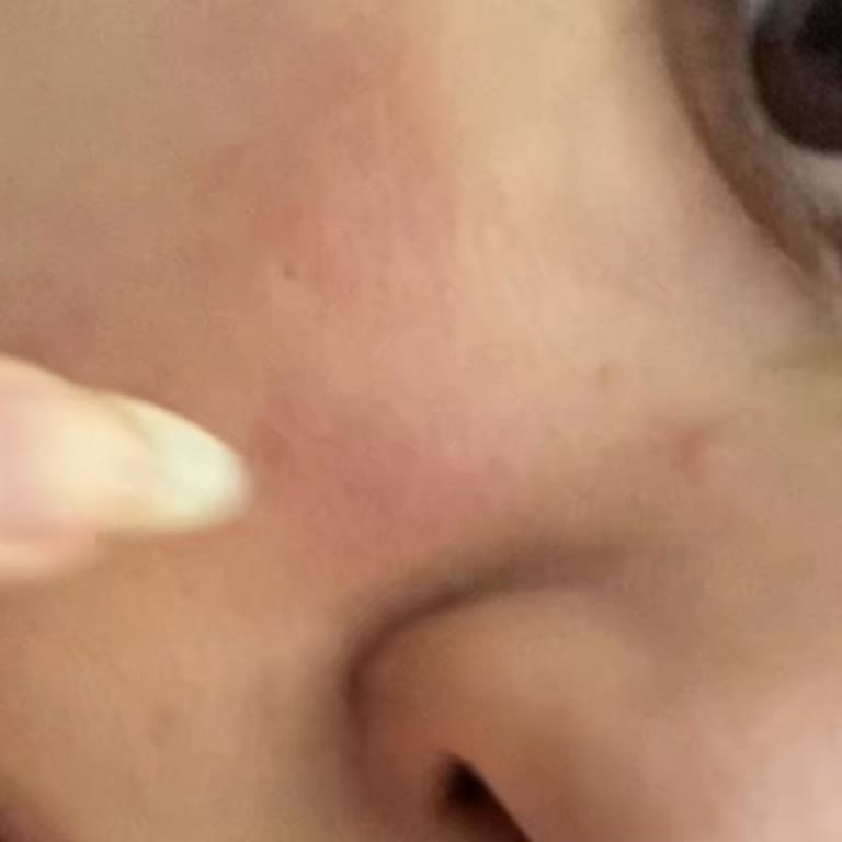 The Ordinary Nemlendirici Cildimi Bozdu