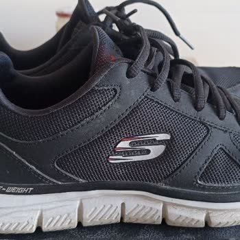 Skechers Ayakkabıda Deformasyon Ve Garanti Sorunu: Carrefour SA Ve Distribütör Arasında Mağduriyet