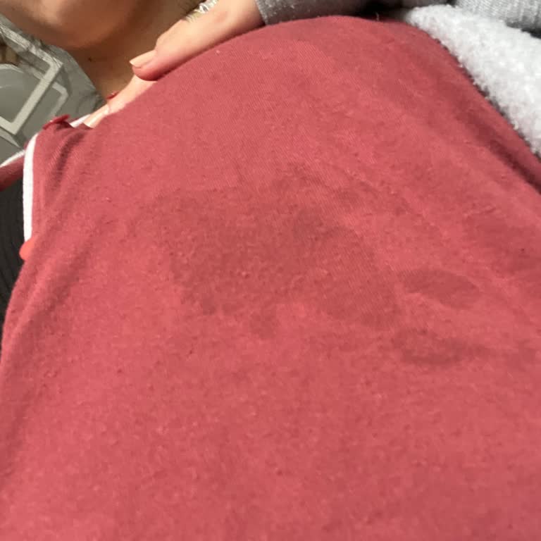 Mochi Göğüs Pompası Süt Sızdırıyor, Verim Düşük