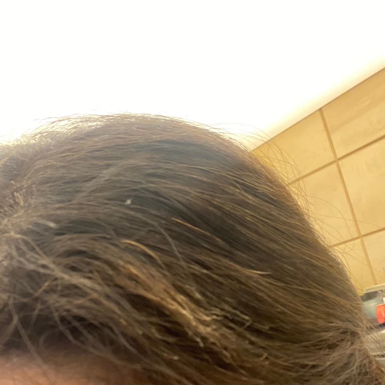 Nişantaşı Bej Şubesinde Saçım Yandı, İlgisiz Ve Laubali Davranışlar