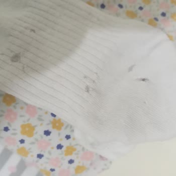 Electrolux Çamaşır Makinesi Sürekli Arızalı Ve Çamaşırları Zedeliyor