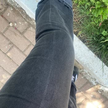Kullanılmamış Pantolonda Oluşan Sorun Ve Mağaza Değişim Sürecindeki Zorluk