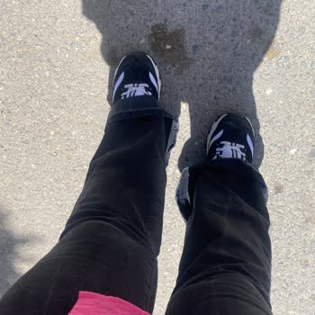 Kullanılmamış Pantolonda Oluşan Sorun Ve Mağaza Değişim Sürecindeki Zorluk