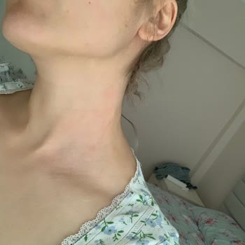 Eski Ve Bozulmuş Parfüm Satışı Nedeniyle Hayal Kırıklığı